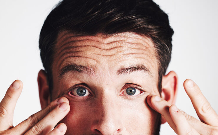 man experiencing contact lens discomfort