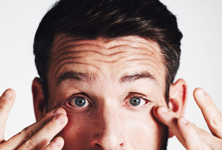 man experiencing contact lens discomfort