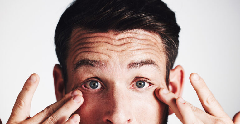 man experiencing contact lens discomfort