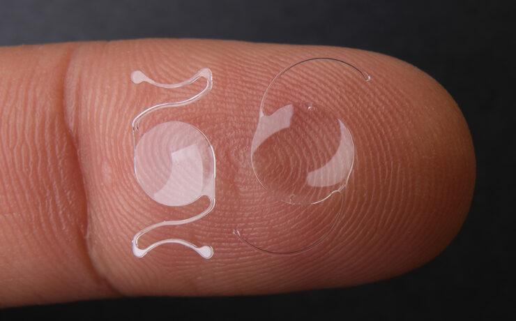 lens implant options